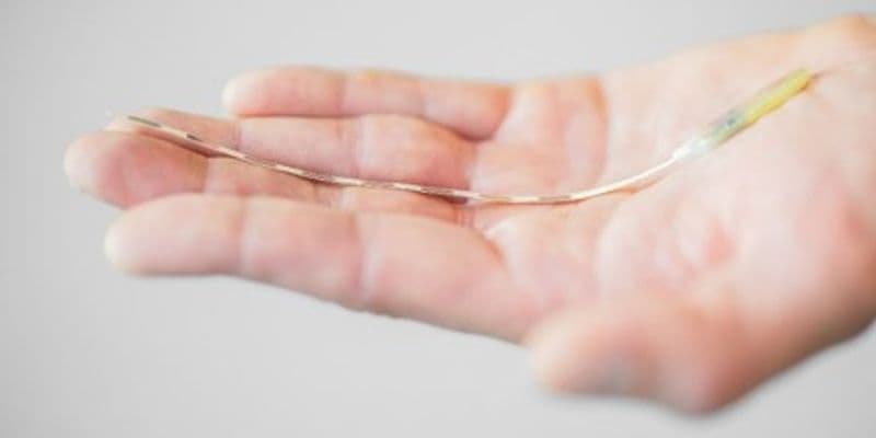 Implante para la migraña crónica - Foto de Erasmus MC