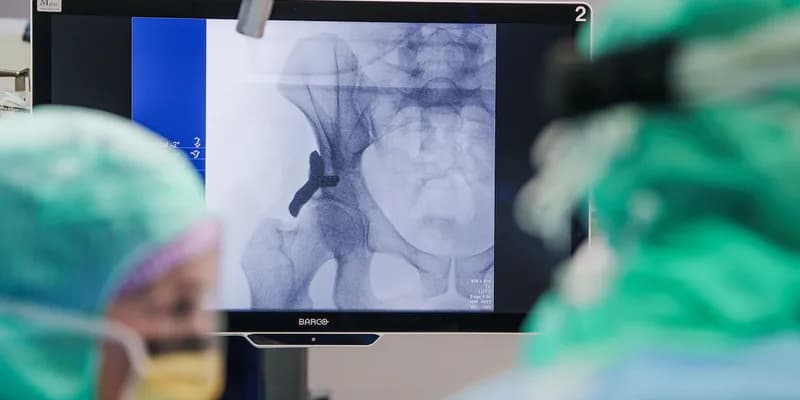 Monitor con implante de cadera 3D